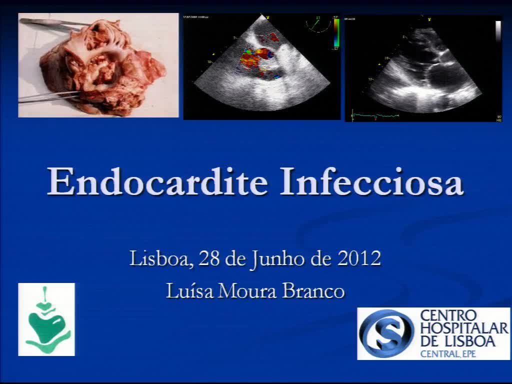 Endocardite Infecciosa