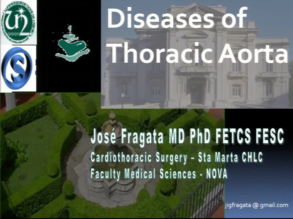 Doenças da Aorta torácica