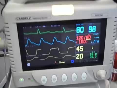 Quiz - Anesthetic Monitoring Video